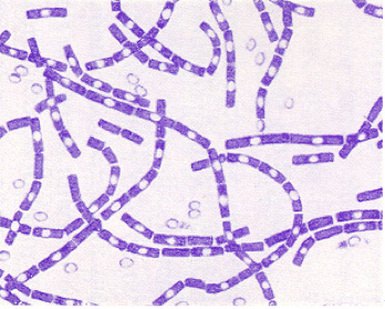 Bacillus Antigens - Creative Diagnostics