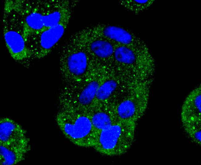 Recombinant Rabbit Monoclonal Antibodies - Creative Diagnostics