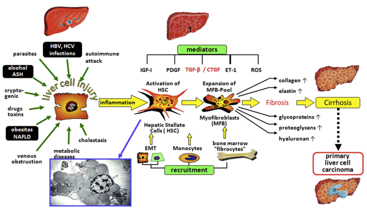 Liver Fibrosis - IVD Raw Materials - Creative Diagnostics