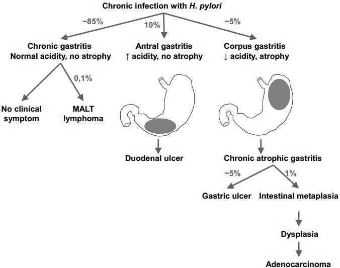 Gastrointestinal infection Hp outcomes