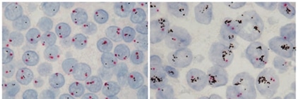 In Situ Hybridization (ISH) - Creative Diagnostics