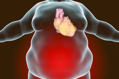 Obese Signaling Pathway