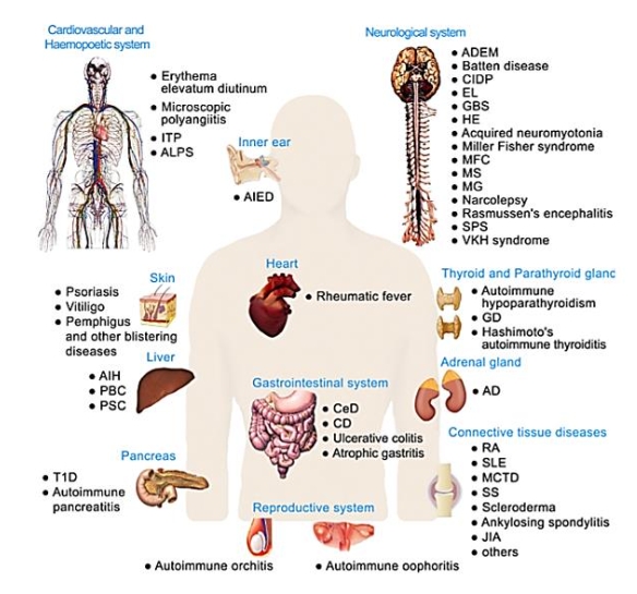 Immunology Topics - Creative Diagnostics