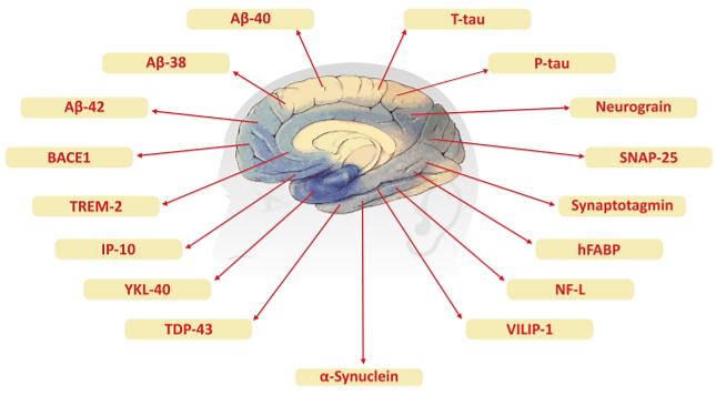 Highly specific and ultrasensitive plasma test detects Abeta(1–42) and  Abeta(1–40) in Alzheimer's disease