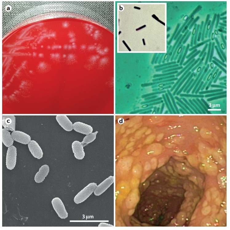 Glutamate Dehydrogenase (GDH) and C. difficile Detection - Creative ...