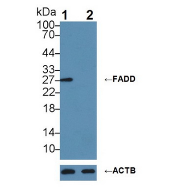 Knockout Validated Antibodies - Creative Diagnostics