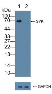 Knockout Validated Antibodies - Creative Diagnostics