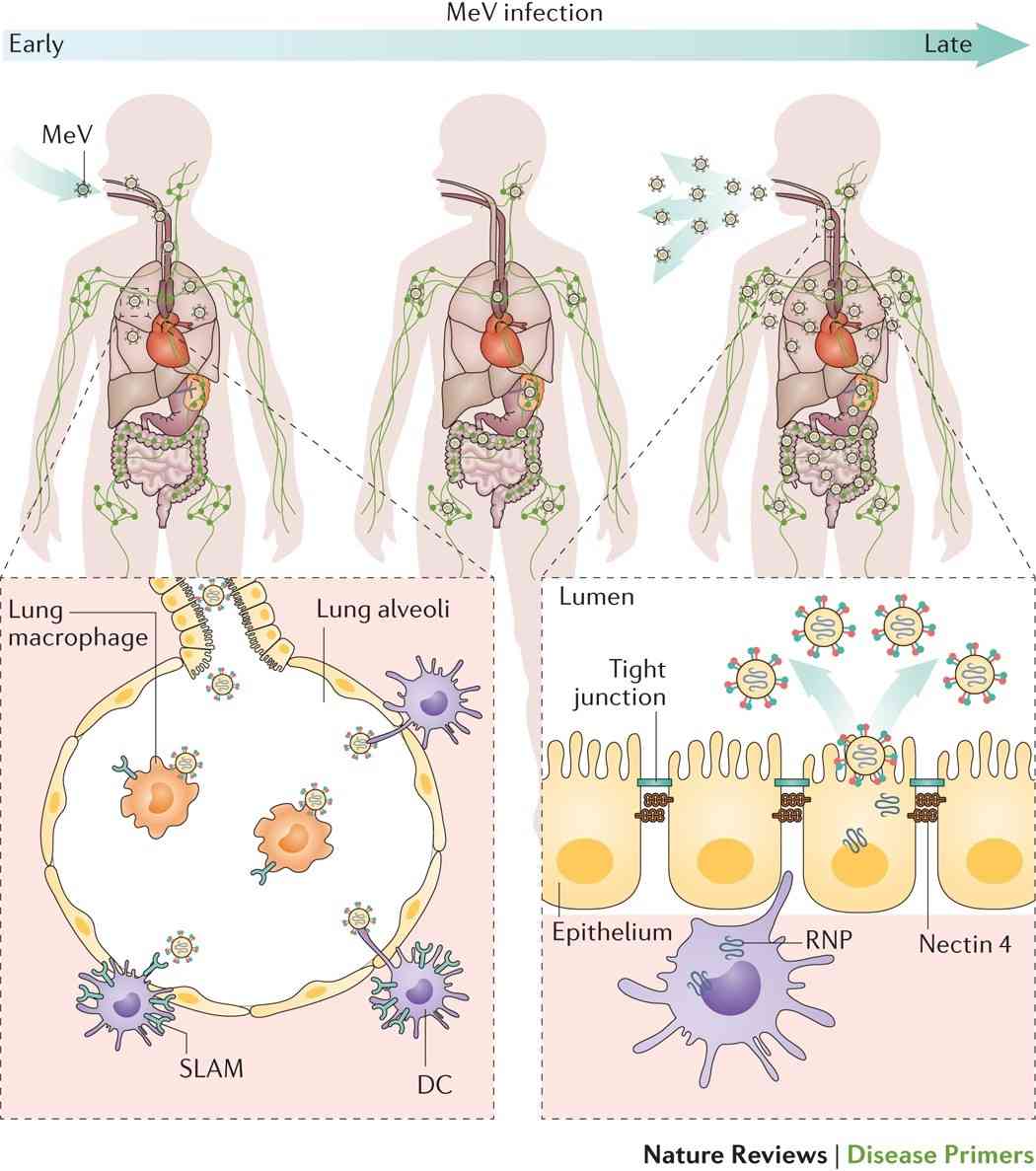 What is Measles Virus? - Creative Diagnostics